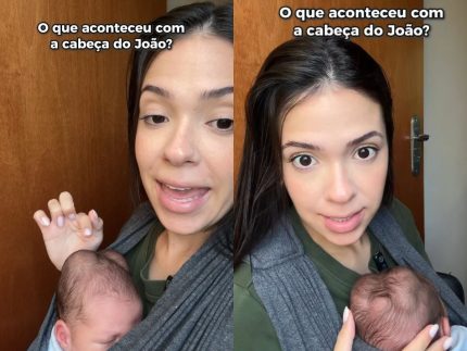 Influenciadora explica 'calombos' na cabeça do filho recém-nascido e revela tratamento